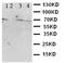 Cystathionine-Beta-Synthase antibody, LS-C312700, Lifespan Biosciences, Western Blot image 