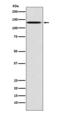 TYRO3 Protein Tyrosine Kinase antibody, M00913-5, Boster Biological Technology, Western Blot image 