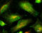 Unc-51 Like Autophagy Activating Kinase 1 antibody, STJ111271, St John