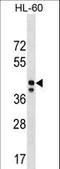 MRPS31 antibody, LS-C158310, Lifespan Biosciences, Western Blot image 