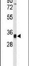 TCF3 Fusion Partner antibody, PA5-26312, Invitrogen Antibodies, Western Blot image 