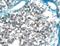 Platelet Derived Growth Factor Receptor Alpha antibody, AF1062, R&D Systems, Immunohistochemistry paraffin image 