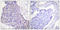 CD40 Molecule antibody, LS-C118600, Lifespan Biosciences, Immunohistochemistry paraffin image 