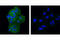 Discoidin Domain Receptor Tyrosine Kinase 1 antibody, 5583S, Cell Signaling Technology, Immunofluorescence image 