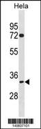 TIMELESS-interacting protein antibody, 60-620, ProSci, Western Blot image 