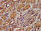 Potassium Voltage-Gated Channel Subfamily J Member 8 antibody, LS-C674944, Lifespan Biosciences, Immunohistochemistry paraffin image 