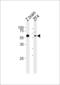 Acid Phosphatase 7, Tartrate Resistant (Putative) antibody, PA5-72659, Invitrogen Antibodies, Western Blot image 