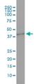 G Protein Subunit Beta 3 antibody, H00002784-M01, Novus Biologicals, Western Blot image 