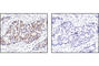 MAPK Activated Protein Kinase 2 antibody, 3007P, Cell Signaling Technology, Immunohistochemistry paraffin image 