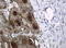 WAP Four-Disulfide Core Domain 2 antibody, M02685-2, Boster Biological Technology, Immunohistochemistry paraffin image 