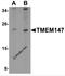 Transmembrane Protein 147 antibody, 6453, ProSci, Western Blot image 