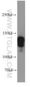 Stromal Antigen 2 antibody, 19837-1-AP, Proteintech Group, Western Blot image 