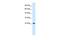 Potassium Voltage-Gated Channel Interacting Protein 2 antibody, PA5-41075, Invitrogen Antibodies, Western Blot image 