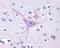 G Protein-Coupled Receptor 32 antibody, NLS1678, Novus Biologicals, Immunohistochemistry paraffin image 