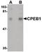 Cytoplasmic Polyadenylation Element Binding Protein 1 antibody, PA5-20561, Invitrogen Antibodies, Western Blot image 