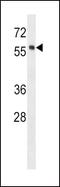 HCK Proto-Oncogene, Src Family Tyrosine Kinase antibody, PA5-14781, Invitrogen Antibodies, Western Blot image 