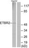 Endothelin B receptor-like protein 2 antibody, A11679, Boster Biological Technology, Western Blot image 