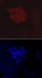 V-Set Domain Containing T Cell Activation Inhibitor 1 antibody, MAB71261, R&D Systems, Immunocytochemistry image 