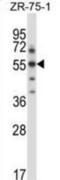 Serum/Glucocorticoid Regulated Kinase Family Member 3 antibody, abx027950, Abbexa, Western Blot image 