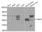 TNF Receptor Associated Factor 6 antibody, abx000926, Abbexa, Western Blot image 
