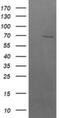 Beta-Transducin Repeat Containing E3 Ubiquitin Protein Ligase antibody, NBP2-46588, Novus Biologicals, Western Blot image 