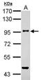 Transforming Growth Factor Beta Receptor 3 antibody, GTX109068, GeneTex, Western Blot image 