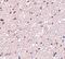 HAP1 antibody, A01658, Boster Biological Technology, Immunohistochemistry paraffin image 