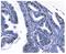 KI-67 antibody, M00254-9, Boster Biological Technology, Immunohistochemistry paraffin image 