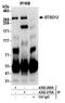 SLX4 Structure-Specific Endonuclease Subunit antibody, A302-269A, Bethyl Labs, Immunoprecipitation image 