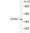 Succinate Receptor 1 antibody, LS-C177305, Lifespan Biosciences, Western Blot image 