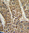 Microsomal triglyceride transfer protein large subunit antibody, 63-765, ProSci, Immunohistochemistry paraffin image 
