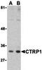C1q And TNF Related 1 antibody, orb74631, Biorbyt, Western Blot image 