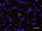 Triggering Receptor Expressed On Myeloid Cells 2 antibody, BAF1729, R&D Systems, Immunocytochemistry image 