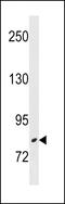 Zinc Finger And BTB Domain Containing 17 antibody, 60-223, ProSci, Western Blot image 