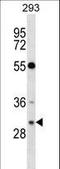 RASD Family Member 2 antibody, LS-B10692, Lifespan Biosciences, Western Blot image 