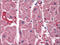 Inositol 1,4,5-Trisphosphate Receptor Type 2 antibody, AP22536PU-N, Origene, Immunohistochemistry paraffin image 