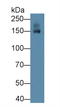 TN-R antibody, LS-C663940, Lifespan Biosciences, Western Blot image 