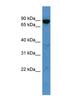 ATP Binding Cassette Subfamily B Member 10 antibody, NBP1-69065, Novus Biologicals, Western Blot image 