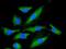 pp60c-src antibody, ab109381, Abcam, Immunocytochemistry image 