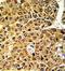 MLX antibody, GTX81125, GeneTex, Immunohistochemistry paraffin image 