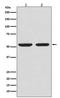 Caspase 8 antibody, M00042-2, Boster Biological Technology, Western Blot image 