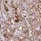 Lysyl Oxidase Like 4 antibody, HPA037609, Atlas Antibodies, Immunohistochemistry paraffin image 