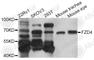 Frizzled Class Receptor 4 antibody, A8161, ABclonal Technology, Western Blot image 