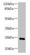 Mediator Complex Subunit 18 antibody, CSB-PA871577LA01HU, Cusabio, Western Blot image 