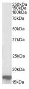 Sodium Voltage-Gated Channel Alpha Subunit 5 antibody, NB600-804, Novus Biologicals, Western Blot image 