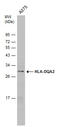 Major Histocompatibility Complex, Class II, DQ Alpha 2 antibody, GTX130259, GeneTex, Western Blot image 