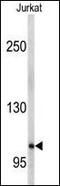 Ephrin A5 antibody, PA1-30295, Invitrogen Antibodies, Western Blot image 