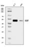 ECSIT Signalling Integrator antibody, A07966-3, Boster Biological Technology, Western Blot image 