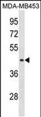 ALG8 Alpha-1,3-Glucosyltransferase antibody, PA5-49039, Invitrogen Antibodies, Western Blot image 