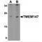 Transmembrane Protein 147 antibody, MBS151046, MyBioSource, Western Blot image 